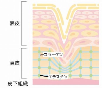 ダメージを受けた肌